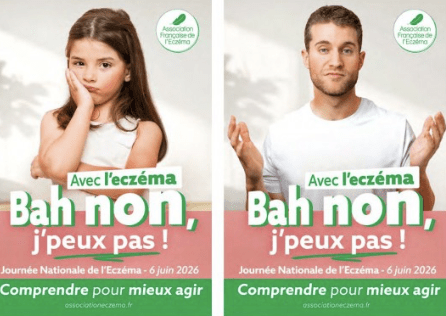 L’Association Française de l’Eczéma alerte sur le fardeau de l’eczéma 